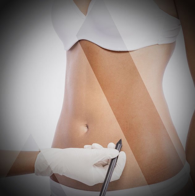 Mini tummy tuck Turkey price